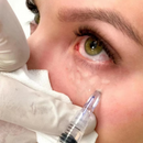 AGUJA 3PIN 34G X 1MM x 20 UND.– NANOSOFT