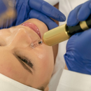 HYALURON PEN FACIAL 2 EN 1 - 0.3ML A 0.5ML